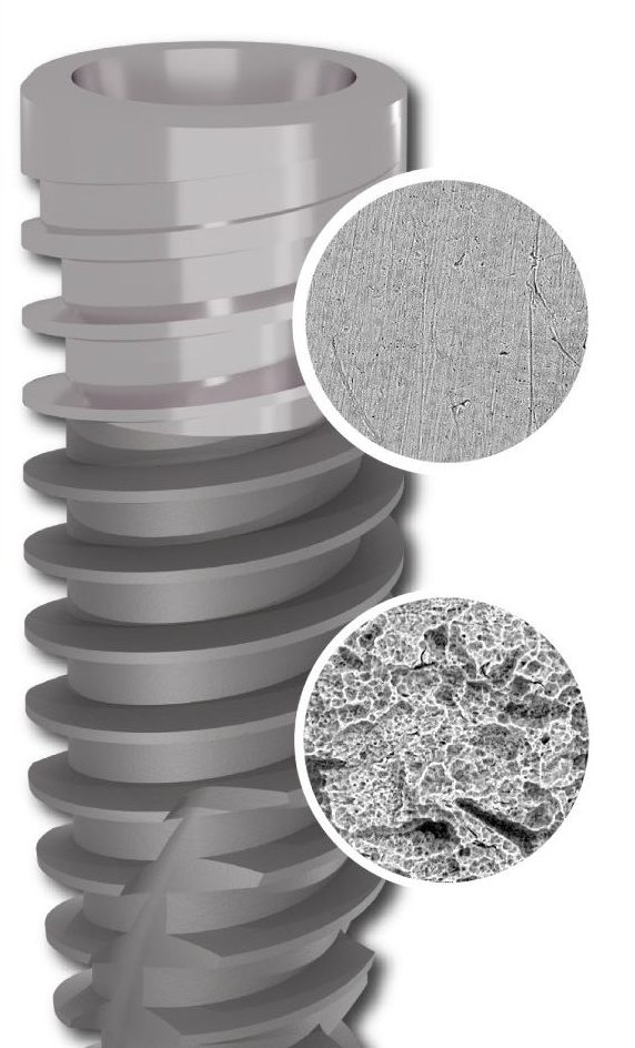 SP1 - implant cu suprafață cu titan